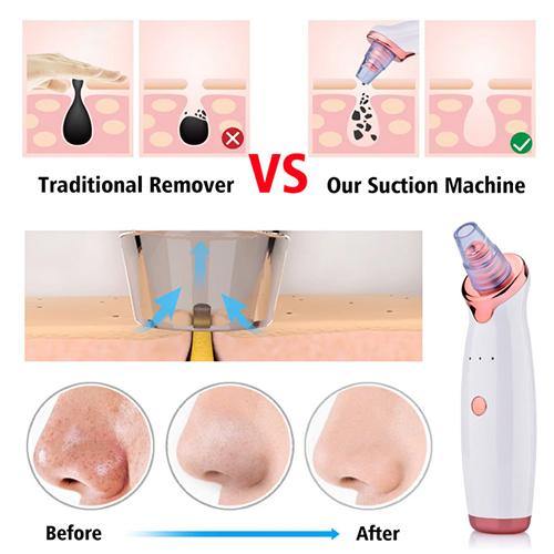 Heyblackhead™ Pore Vacuum Cleaner Blackhead Remover - heyblackhead